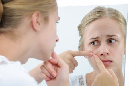 DIY Dermatologist?  Why you pop your pimples and how to stop