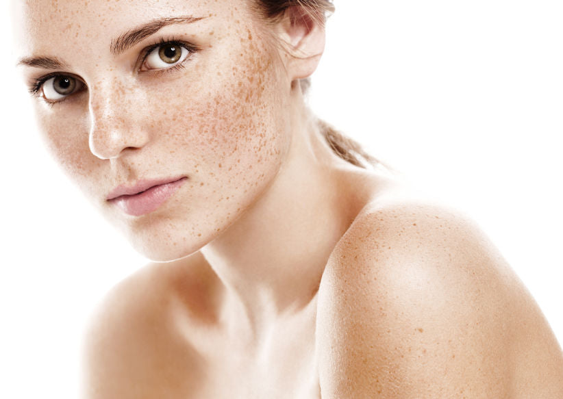 Do's and Don't's of summer hyperpigmentation facial treatments